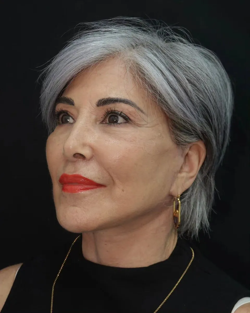 Facelift before and after
