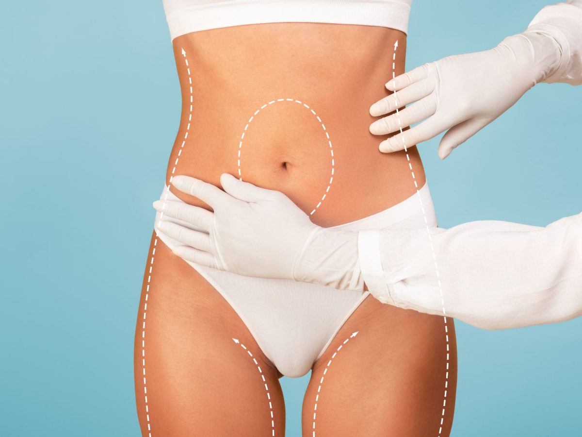 Weight Gain After Abdominoplasty: How To Prevent It: Stay Fit After Surgery: Your Guide to Preventing Weight Gain!
